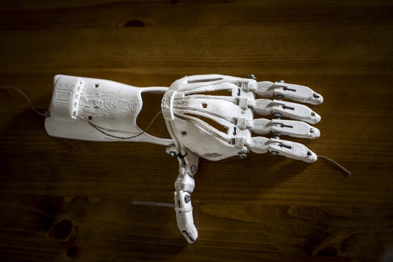 3D printed hand prosthesis
